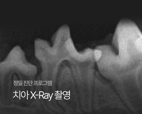 치과센터 스와이퍼이미지 03