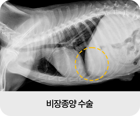 종양외과 수술 이미지02