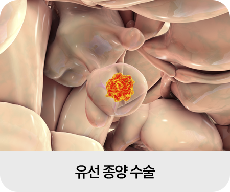 종양외과 수술 이미지04