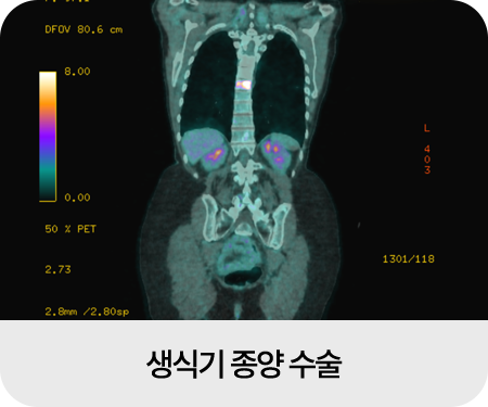 종양외과 수술 이미지05